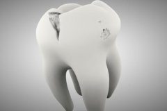 牙齿缺损的原因有哪些?